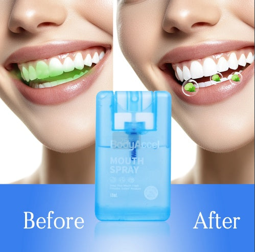 Oral Care Spray