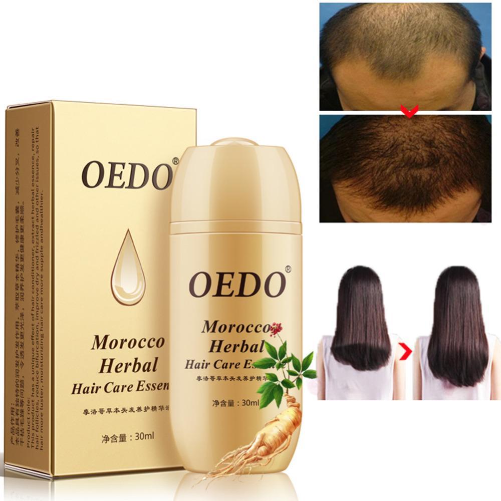 OEDO Moroccan Herbal Hair Care Essence